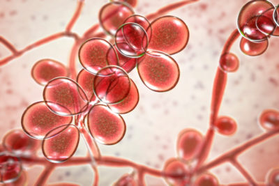 Jeder Hausarzt kennt das Problem der immer wiederkehrenden Kandidosen. Die Verzweiflung der Patientinnen ist groß, wenn die vaginale Infektion immer wieder kommt. Auch der chronische Soor, die Windeldermatitis bei Seniorinnen, ist eine immer häufigere Infektion. Der Erreger ist fast immer Candida albicans, ein an den Menschen perfekt angepasster Pilz mit hoher Persistenz. Ein meisterhafter Opportunist, der dennoch heilbar ist.