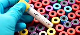 HIV Test