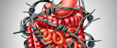 Häufigste Nebenwirkung einer längerfristigen Opioidbehandlung ist eine Form der Obstipation, die die Lebensqualität der Betroffenen erheblich beeinträchtigen kann und oft unzureichend auf die gängigen Basismaßnahmen anspricht. Die Deutsche Gesellschaft für Schmerzmedizin hat nun ausführliche Praxisleitlinien erstellt.