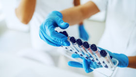 Labor tests