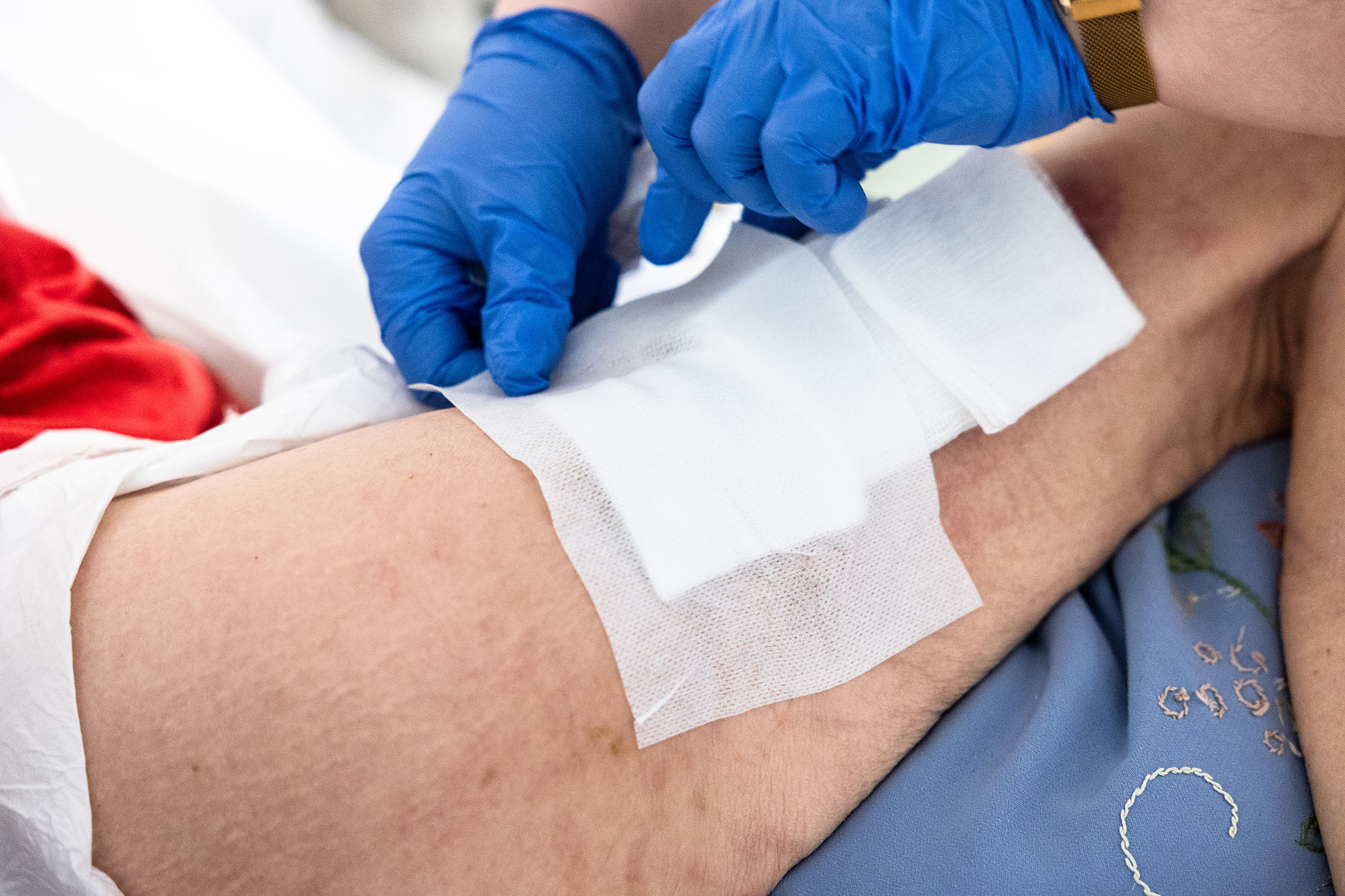 Verband auf Bein