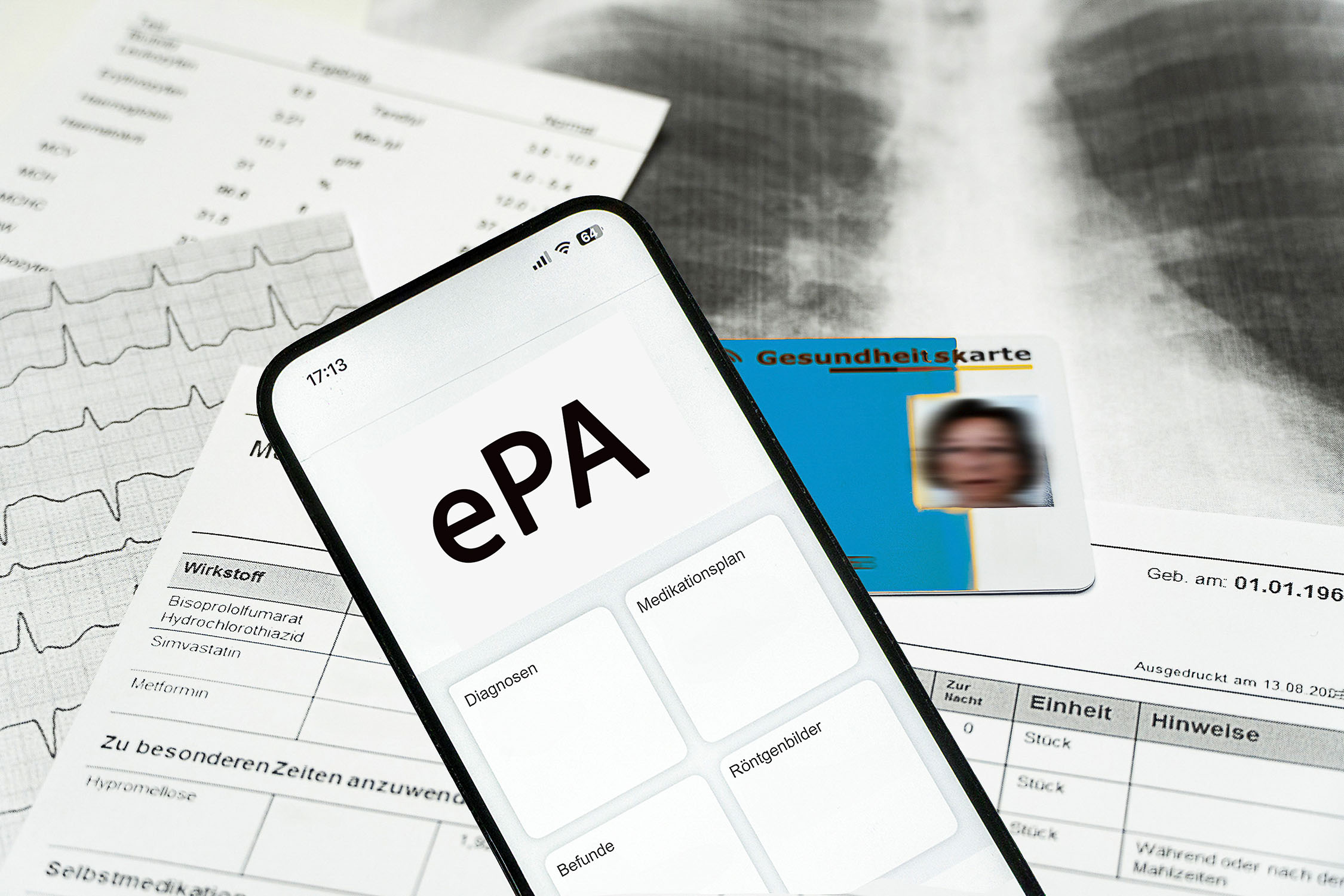 Symbolisierte ePA auf dem Smartphone liegt über ausgedruckten Behandlungsdokumenten