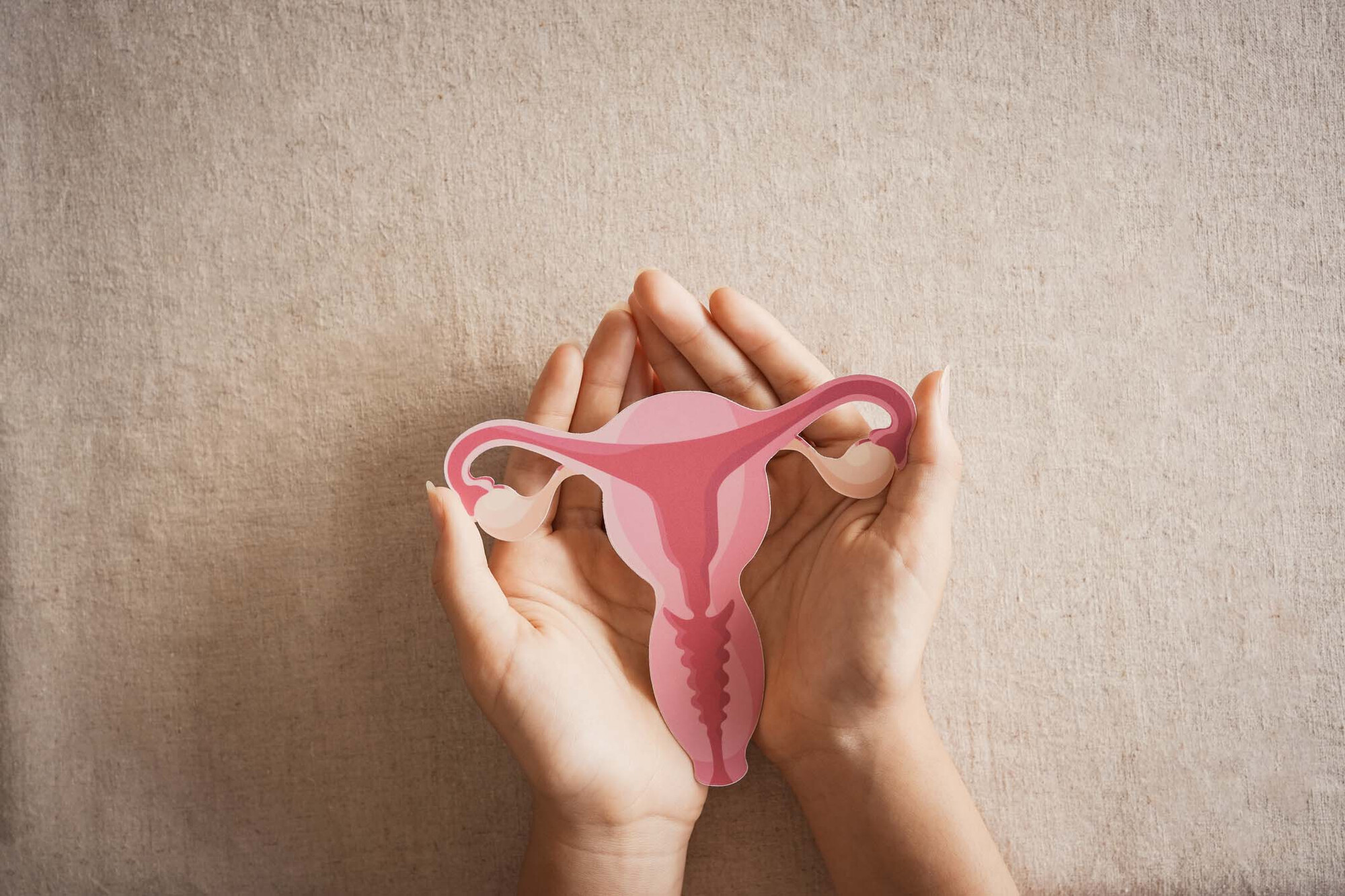 PCOS